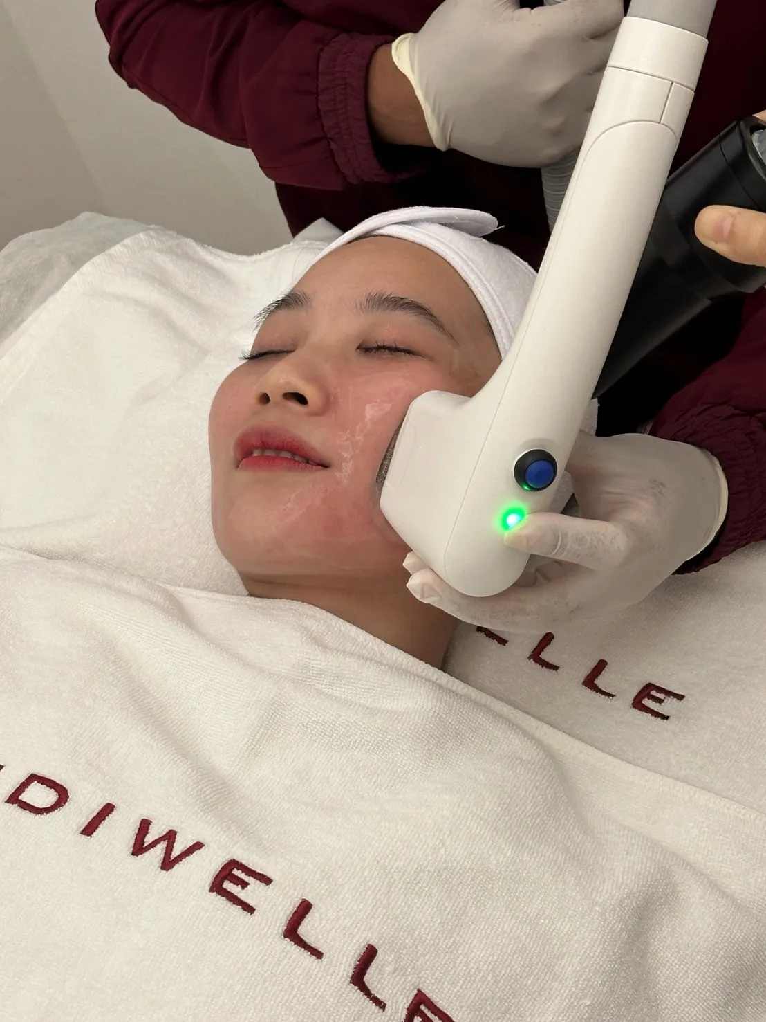 รีวิว sofwave