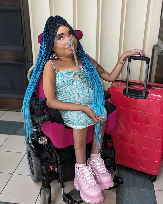นางแบบ, นางแบบพิการ, นางแบบคนพิการ, คนพิการ